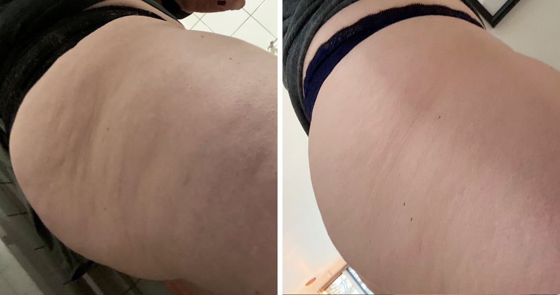 Prima e dopo Nadia Balde